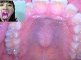 【HD】街角で声をかけて口内観察させてもらう　アパレル関係　ひなみちゃん